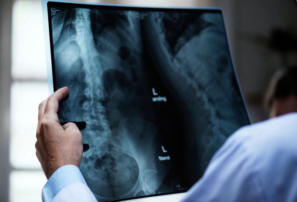 The Importance of Radiology Service at Home