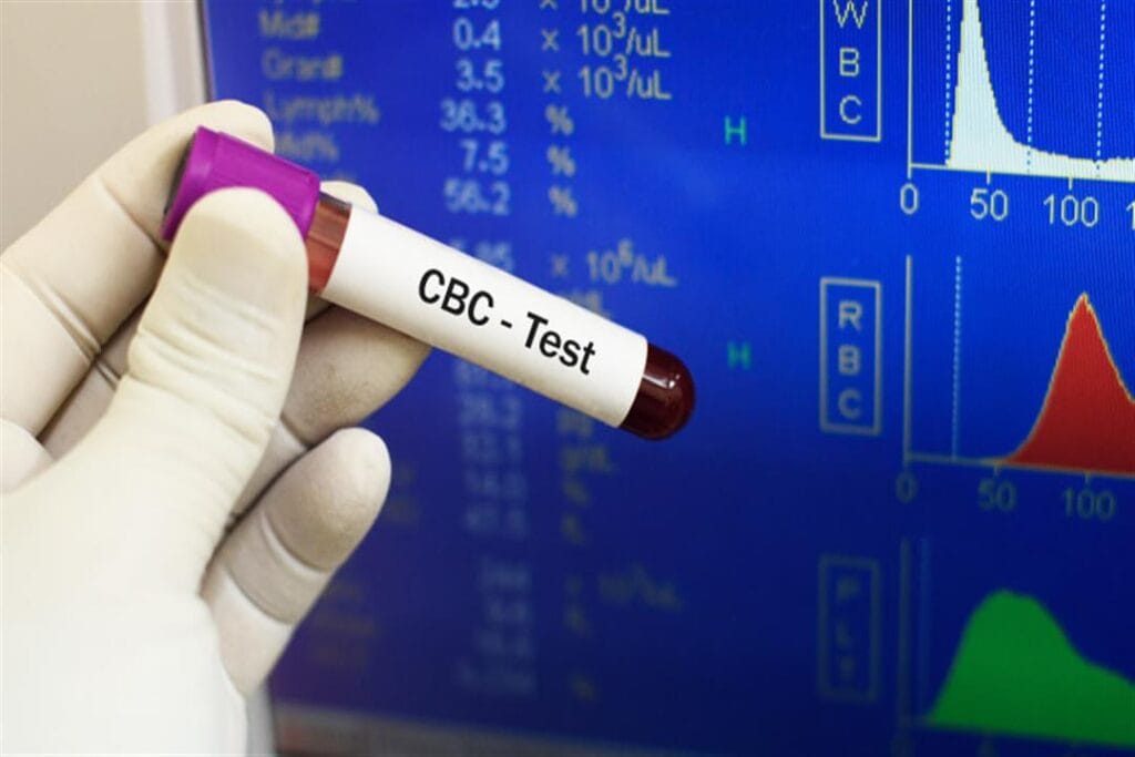 تحليل cbc وصورة الدم الكاملة