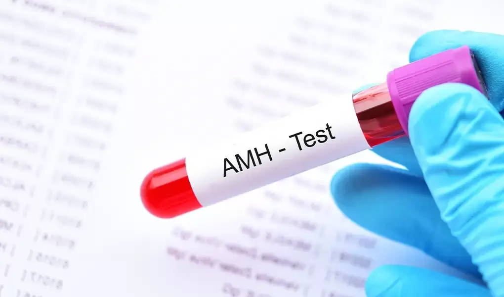 تحليل مخزون المبيض و AMH للنساء: متى تطلبه الطبيبة وما علاقته بتأخر الحمل؟